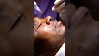 &ldquo;Deep Cleaning Nose Pores | Vacuum vs. Blackheads ASMR Edition&rdquo;