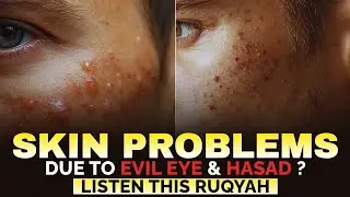 Ruqyah For Skin Problems Due To Evil Eye / Hasad | Ruqyah For Face Problems
