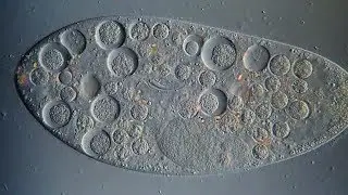 Paramecium Characteristic & Structure | Under The Microscope