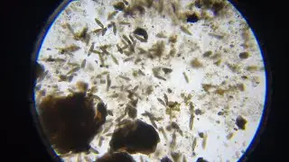 Paramecium on egg yolk. No audio.