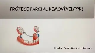 Biomecânica em Prótese Parcial Removível- Parte 1