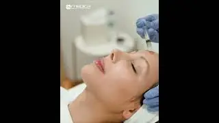 Face Bio Revitalization : PRXT Treatment @ Beverly Hills Wellness and Aesthetic Center