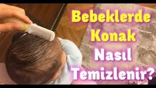 Bebeklerde Konak Nasıl Geçer? #bebeklerdekonak #konak
