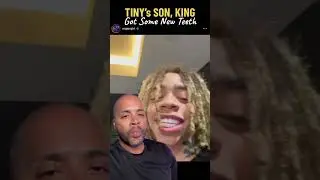 Tiny&rsquo;s Son, King Harris Gets NEW Teeth!
