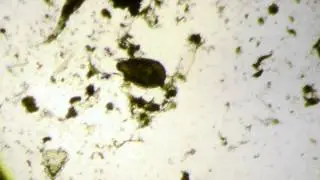 Carl Zeiss microscope, Life from the Moss....Arthropod