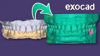 Учебное пособие по МОДЕЛИ ИМПЛАНТАТА 2025 EXOCAD