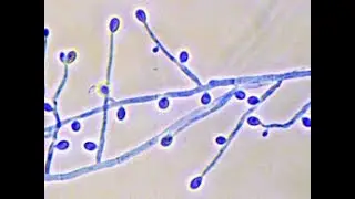 Scedosporium Boydii Fungus ; Definition, Classification, Habitat, Pathogenicity, Life Cycle
