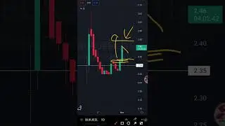 Burjeel Price Action Today