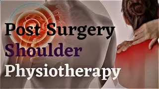 shoulder pain relief exercises|  shoulder pain surgery in hindi | Rotator Cuff Impingement Exercises
