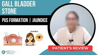 Best Hospital for Gall Bladder Stone in Kapurthala | Best Gall Bladder Doctor | Treatment