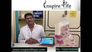 Correct your spinal deformity ||  Inspire Life Prosthetics & Orthotics LLP