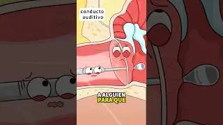 👂&iquest;Qu&eacute; pasa si accidentalmente te perforas el t&iacute;mpano?❓#shorts