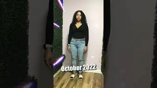 -61 Lbs In 5 Month After Her Endoscopic Sleeve Gastroplasty (Suture Sculpt) Procedure 🔥❗️