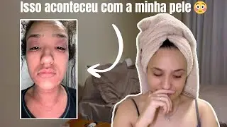 Minha rotina de autocuidado depois da pior alergia que já tive