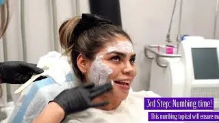 PRP Microneedling with Fernanda Flores