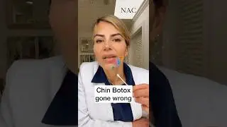 Ботокс для подбородка пошёл не так #ботокс #плохойботокс #drbitafarrell