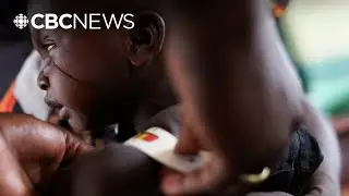 U.S. foreign aid cuts fuelling 'era of global health austerity': study