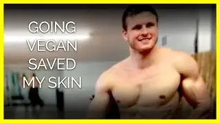 Going Vegan Cleared my Acne | Body Builder Brian Turner