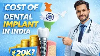 Dental implant cost in India | Implant Types and cost | Face Art Clinic Kolhapur #dental #kolhapur