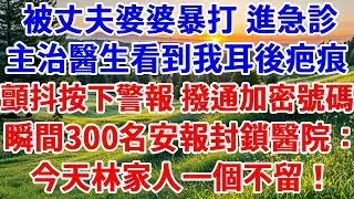 被丈夫婆婆暴打 進急診，主治醫生看到我耳後疤痕，顫抖著按下警報 撥通加密號碼，瞬間300名安報封鎖醫院：今天林家人一個不留！#詩涵講故事#為人處世#生活經驗#情感故事#晚年哲理#說故事#完結#原創故事