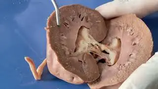 Dissection of Sheep Kidney Practical