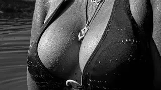 My Breast Journey Part 6 Breast Explant and Breast Reduction: 1 wk post Real Photos. *** WARNING ***