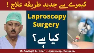 Top Laparoscopic Surgeon - Dr. Sadaqat Ali Talks on Advanced Laparoscopic Surgery, Appendix & Hernia
