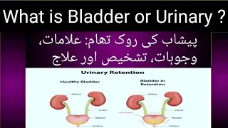 Pishaab khul ke Na Ana / Urinary system problem