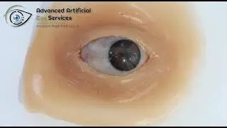 Advance artificial eye service best prosthetic eye service in meerut