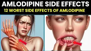 12 Worst Side effects of Amlodipine You Should NEVER Ignore!