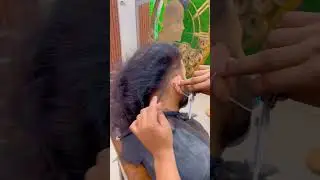 Anas Sheikh Hair Solution | #Shorts #viral #hairpatch #patch #wigs #patchvideo | 9650914665