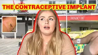 THE CONTRAC*PTIVE IMPLANT- My Story. | Lucy Flight
