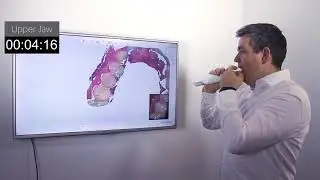 TRIOS 3 WIRELESS INTRAORAL SCANNER | DIGITAL DENTISTRY