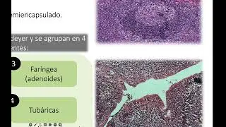 Tejido linfoide PARTE 2 - (MALT, Timo, Bazo, Ganglio linfático)