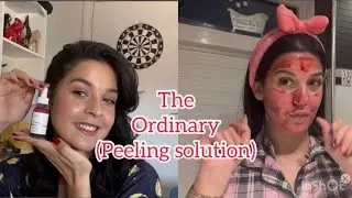 The ordinary(peeling solution) حرقت وجهي😱⚠️كل ما يجب معرفته عن هاد المنتج|تجربتي|واش نصحك تجربيه؟