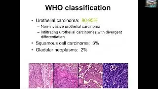 Urine / Bladder Pathology for PCPs -- David Zhang, MD [Excelsior Lecture Series]