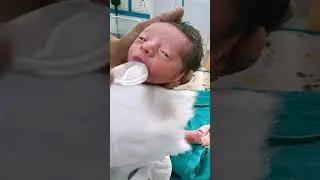 Pretarm baby feeding #neonatology #nursing #viral #video