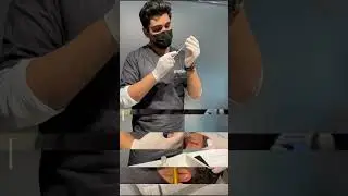 PRP Hair Treatment! 🌟 Super Saving Alert! 🌟