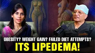 Weight Loss Not Working? Painful Fat Could Be Lipedema, Not Obesity | Dr. Srinagesh Podcast