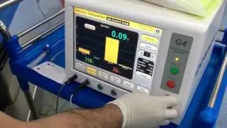 Medial cord recovery after stimulation