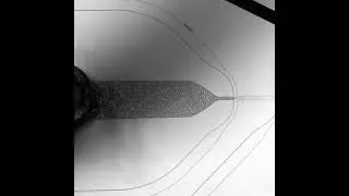 High-throughput droplets-based microfluidics - Droplets passing through a sorting chip