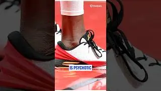 Компания Skechers заплатила Джоэлу Эмбииду за игру в баскетбол без носков?