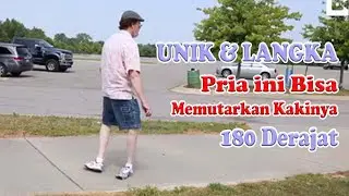 Unik,Langka, dan Nyata. Pria ini Bisa Memutarkan Kakinya 180 Derajat. ||  Mozes Lanham asal Michigan