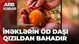 ARB XƏBƏR - İnəyin öd daşı 100 min manata satılır - Süni yolla “zənginlik” xəstəliyi
