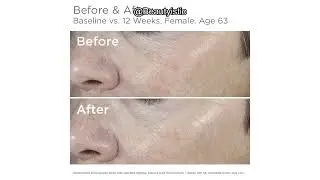 SkinMedica Total Defense + Repair SPF 34 Review: Is It Worth the Hype for Oily Skin?