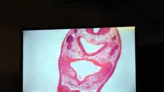 Developmental bio lab review: part 3 (frogs)