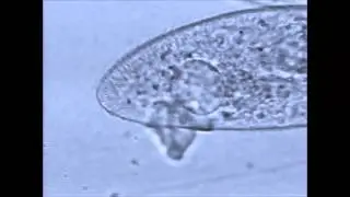 Paramecium Contractile Vacuoles