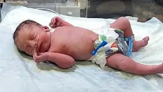 RDS Baby Severe Grunting 😢 | First NICU Management 🏥🍼 | Pray for Baby ❤️