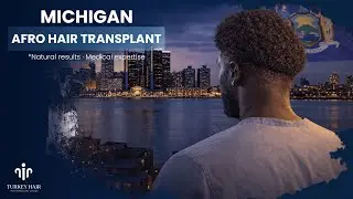 Michigan Afro Hair Transplant Explained | Techniques, Costs & What to Expect