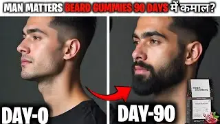 Man matters beard gummies review 90 दिनों का कमाल | man matters hair gummies review 2025 | beard